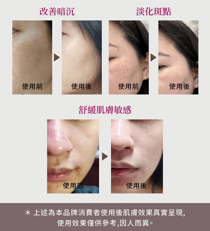 【α Mito】山竹植萃美白護膚凝膠 30ml/瓶：圖片 4